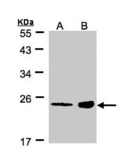 RRAS Antibody, Novus Biologicals 0.1mL; Unlabeled:Antibodies, Polyclonal