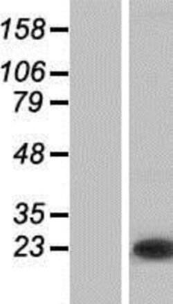 Novus Biologicals&trade;&nbsp;TC21/R-Ras2 Overexpression Lysate
