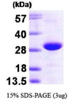 Novus Biologicals&trade;&nbsp;Recombinant Human TC21/R-Ras2 His Protein