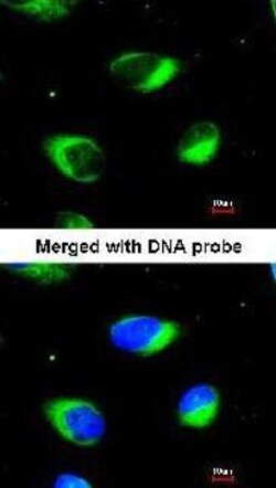 RRBP1 Antibody, Novus Biologicals 0.1mg; Unlabeled:Antibodies, Polyclonal