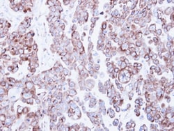RRBP1 Antibody, Novus Biologicals 0.1mg; Unlabeled:Antibodies, Polyclonal