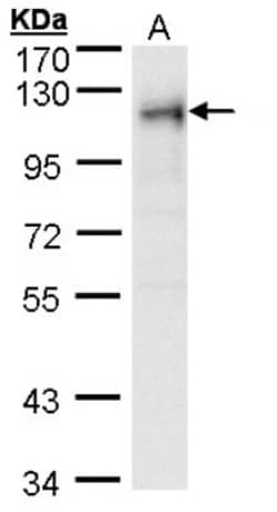 RRBP1 Antibody, Novus Biologicals 0.1mg; Unlabeled:Antibodies, Polyclonal