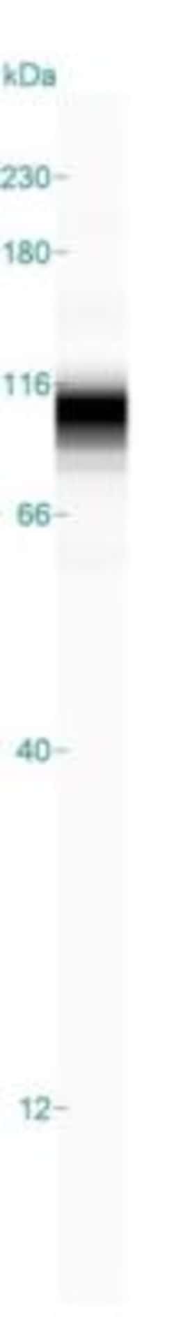 RRBP1 Antibody, Novus Biologicals 25 &mu;L; Unlabeled:Antibodies, Polyclonal