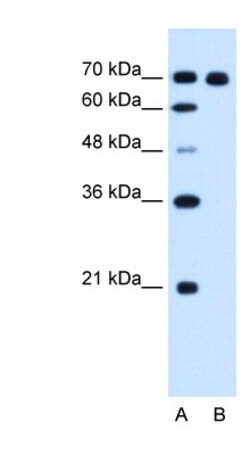 RRM1 Antibody, Novus Biologicals 0.1mg; Unlabeled:Antibodies, Polyclonal