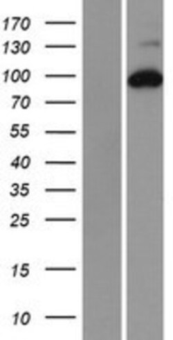 Novus Biologicals&trade;&nbsp;RRM1 Overexpression Lysate