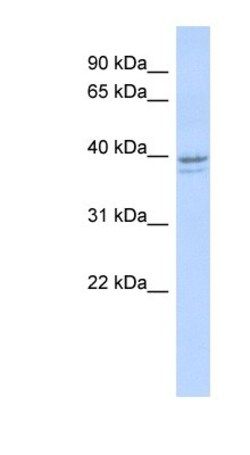 RRM2 Antibody, Novus Biologicals 100&mu;L; Unlabeled:Antibodies, Polyclonal