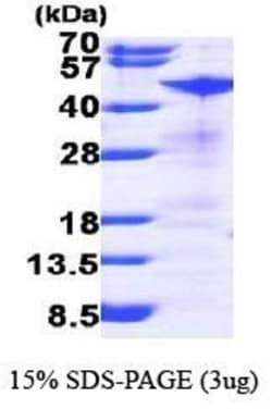 Novus Biologicals&trade;&nbsp;Recombinant Human RRM2 His Protein