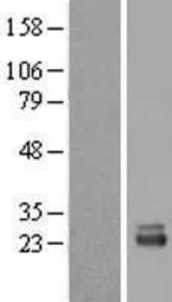 Novus Biologicals™ RRP1 Overexpression Lysate