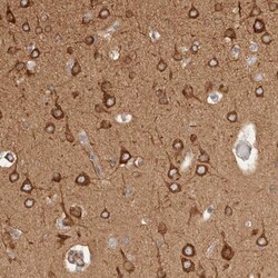 RRP15 Antibody, Novus Biologicals:Antibodies:Primary Antibodies
