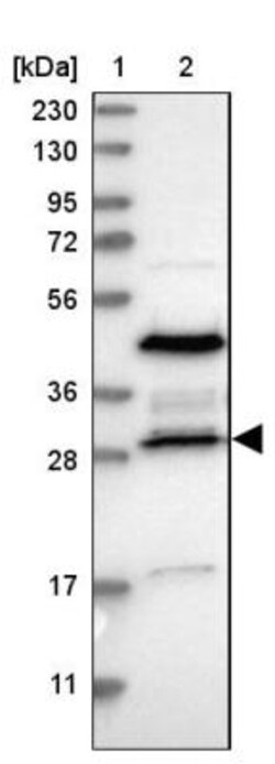 RRP15 Antibody, Novus Biologicals:Antibodies:Primary Antibodies