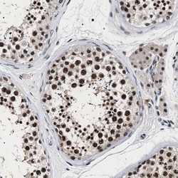 RRP1B Antibody, Novus Biologicals:Antibodies:Primary Antibodies