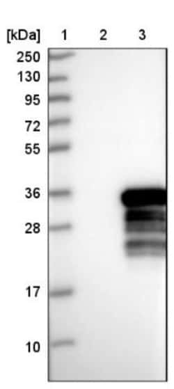 RRP36 Antibody, Novus Biologicals:Antibodies:Primary Antibodies