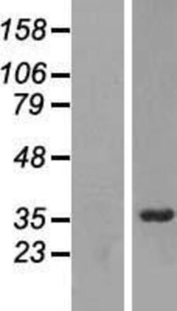 Novus Biologicals&trade;&nbsp;RRP7A Overexpression Lysate