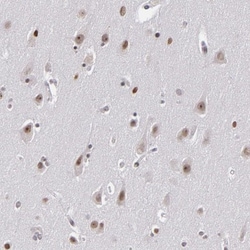 RRP7A Antibody, Novus Biologicals 25 &mu;L; Unlabeled:Antibodies, Polyclonal