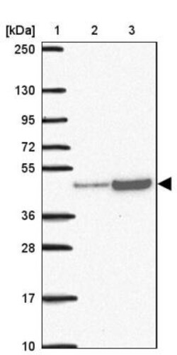 RRS1 Antibody, Novus Biologicals:Antibodies:Primary Antibodies