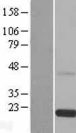 Novus Biologicals&trade;&nbsp;RS1 Overexpression Lysate