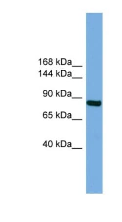 RSBN1 Antibody, Novus Biologicals 100&mu;L; Unlabeled:Antibodies, Polyclonal