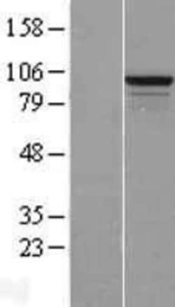 Novus Biologicals™ RSBN1L Overexpression Lysate