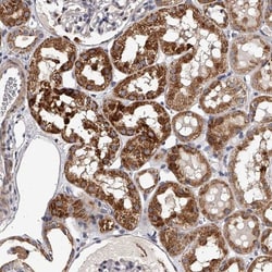 RSC1A1 Antibody, Novus Biologicals 0.1mL; Unlabeled:Antibodies, Polyclonal