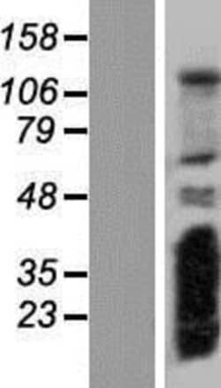Novus Biologicals&trade;&nbsp;RSG1 Overexpression Lysate