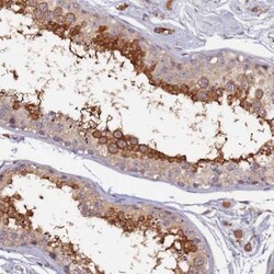 RSHL1 Antibody, Novus Biologicals 25 &mu;L, Unconjugated:Antibodies, Polyclonal