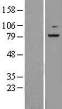 Novus Biologicals™ RSK3 Overexpression Lysate