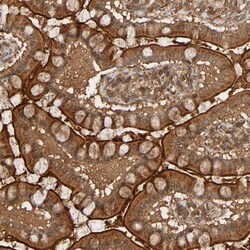 RSK4 Antibody, Novus Biologicals:Antibodies:Primary Antibodies