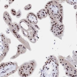 RSL1D1 Antibody, Novus Biologicals 25 &mu;L, Unlabeled:Antibodies, Polyclonal