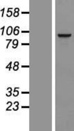 Novus Biologicals&trade;&nbsp;RSPH10B Overexpression Lysate