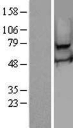 Novus Biologicals&trade;&nbsp;RSPH3 Overexpression Lysate