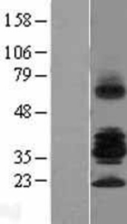 Novus Biologicals&trade;&nbsp;R-Spondin 3 Overexpression Lysate