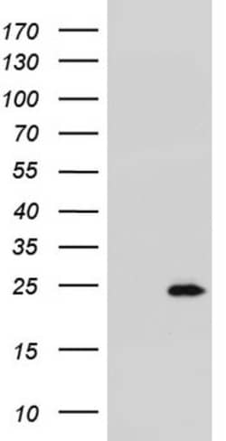 R-Spondin 1 Antibody (OTI11A9), Novus Biologicals 0.1mL; Unlabeled:Antibodies,