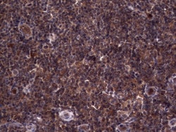 R-Spondin 3 Antibody (OTI3D5), Novus Biologicals 0.1mL; Unlabeled:Antibodies,