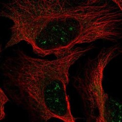 R-Spondin 1 Antibody, Novus Biologicals 25 &mu;L | Buy Online | Novus Biologicals | Fisher Scientific