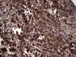 R-Spondin 3 Antibody (OTI3D5), Novus Biologicals 0.1mL; Unlabeled:Antibodies,