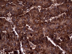 R-Spondin 3 Antibody (OTI3D5), Novus Biologicals 0.1mL; Unlabeled:Antibodies,