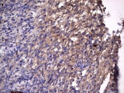 R-Spondin 3 Antibody (OTI3D5), Novus Biologicals 0.1mL; Unlabeled:Antibodies,
