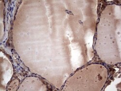 R-Spondin 3 Antibody (OTI3D5), Novus Biologicals 0.1mL; Unlabeled:Antibodies,