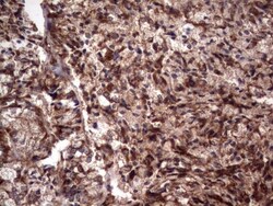 R-Spondin 3 Antibody (OTI3D5), Novus Biologicals 0.1mL; Unlabeled:Antibodies,