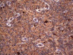 R-Spondin 3 Antibody (OTI3D5), Novus Biologicals 0.1mL; Unlabeled:Antibodies,