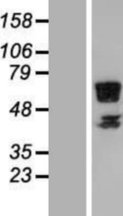 Novus Biologicals&trade;&nbsp;RSPRY1 Overexpression Lysate