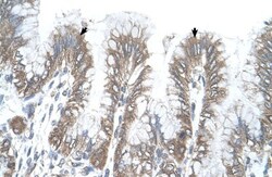 RSRC2 Antibody, Novus Biologicals:Antibodies:Primary Antibodies