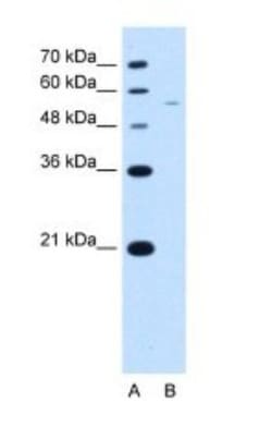 RSRC2 Antibody, Novus Biologicals:Antibodies:Primary Antibodies