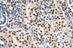 RSU1 Antibody, Novus Biologicals 0.1mg; Unlabeled:Antibodies, Polyclonal