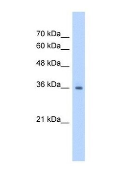 RSU1 Antibody, Novus Biologicals 0.1mg; Unlabeled:Antibodies, Polyclonal