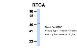 RTCD1 Antibody, Novus Biologicals 100 &mu;L | Buy Online | Novus Biologicals | Fisher Scientific