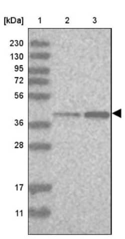 RTCD1 Antibody, Novus Biologicals 0.1mL; Unlabeled:Antibodies, Polyclonal