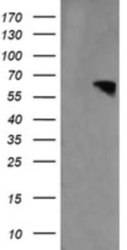 RTKN Antibody (OTI2E9), Novus Biologicals 0.1mL; Unlabeled:Antibodies,