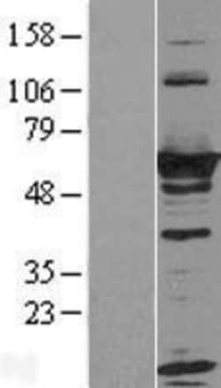 Novus Biologicals&trade;&nbsp;RTKN Overexpression Lysate