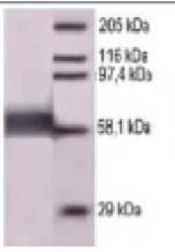 Rabbit anti-Rubeola (Measles) Nucleoprotein, Polyclonal, Novus Biologicals
